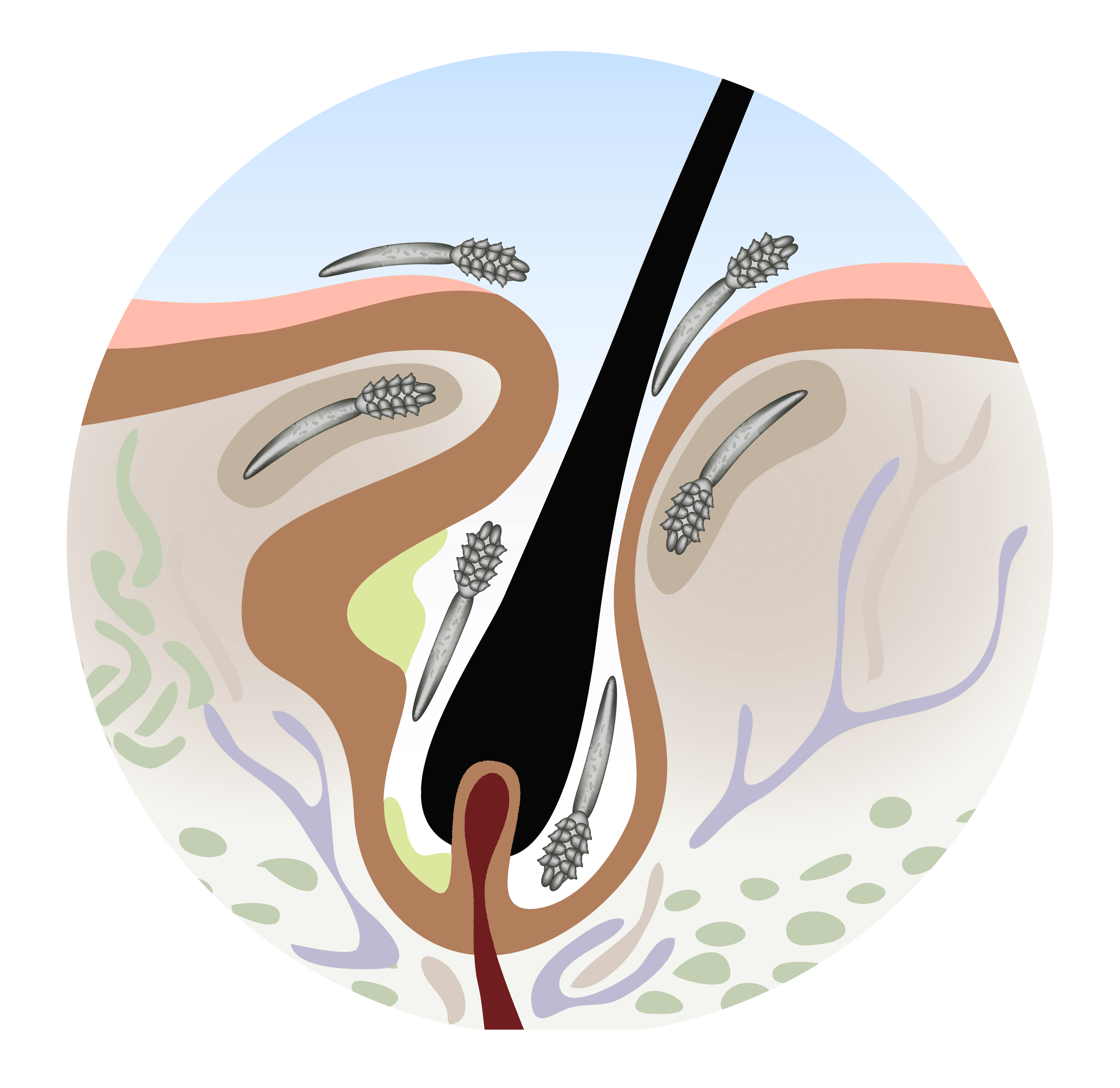 nuzeniec leczenie domowe