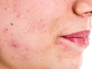 Czego nie lubi nużeniec - Sprawdź i działaj1